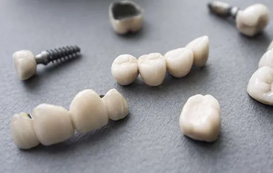 Dental Implants